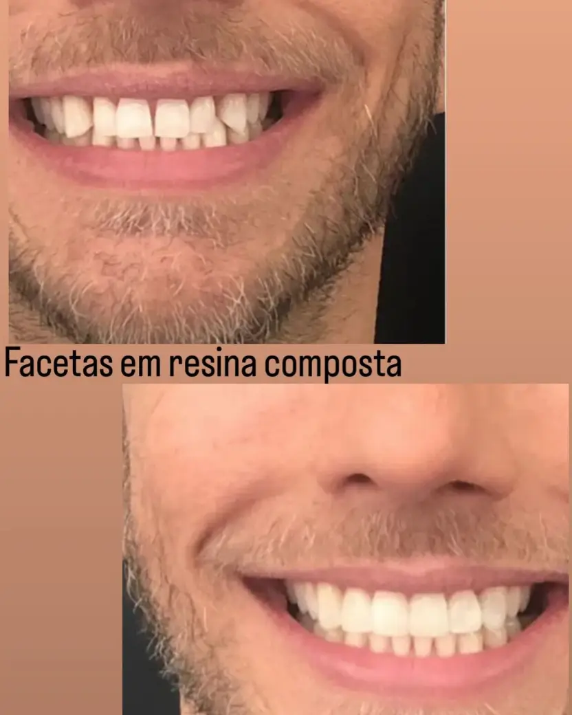 servicos fiore odontologia 8